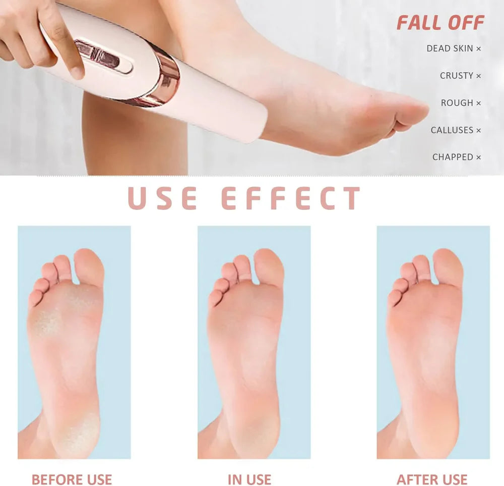 Professional Pedicure Tool | Electric Foot Callus Remover